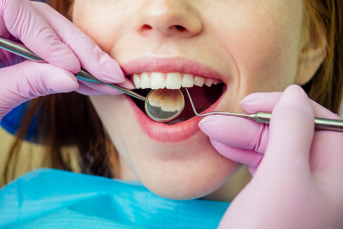 dental-drilling-procedure-and-check-up-on-beautifu-2022-05-12-00-50-25-utc (1)