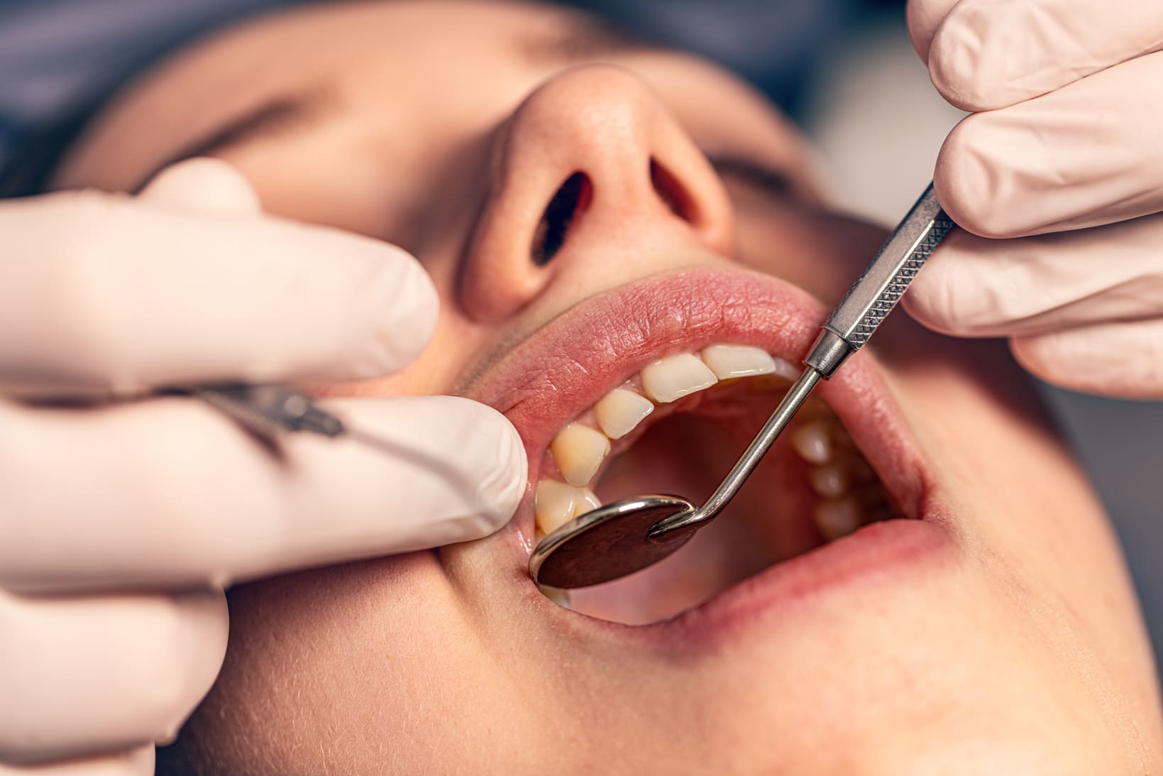 female-having-her-teeth-examinated-2022-03-16-22-08-59-utc (1)